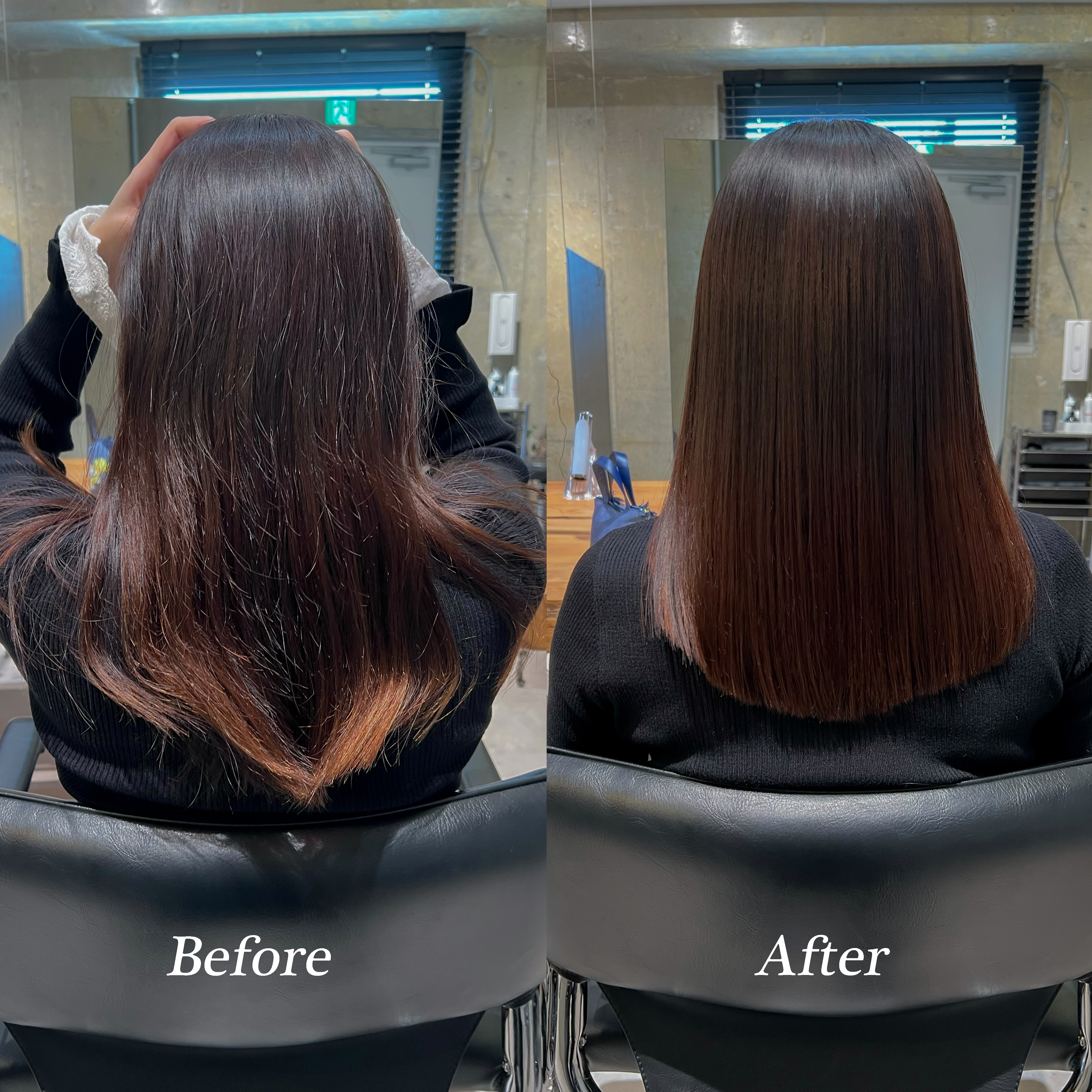 施術例1 - Before & After