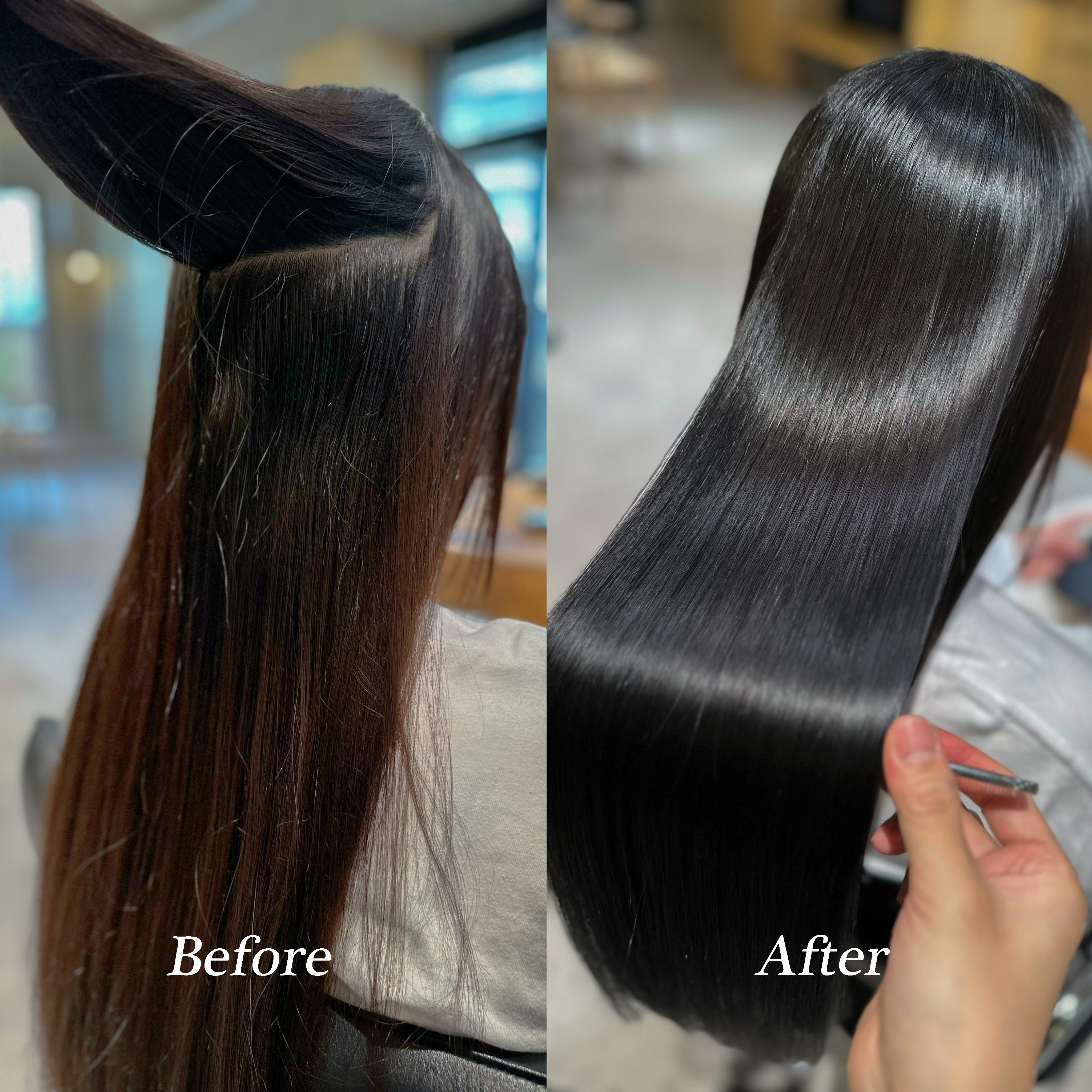 施術例2 - Before & After