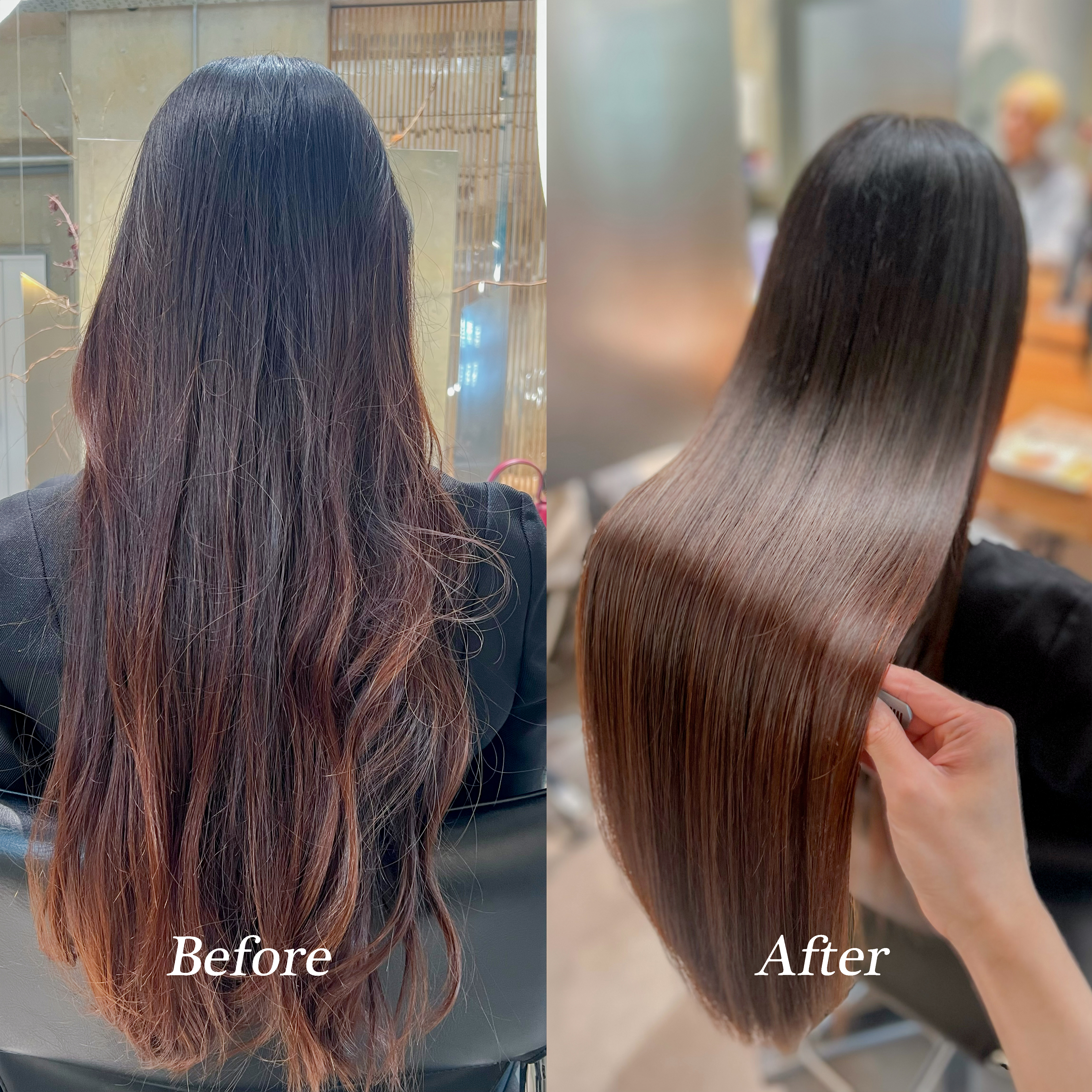 施術例5 - Before & After