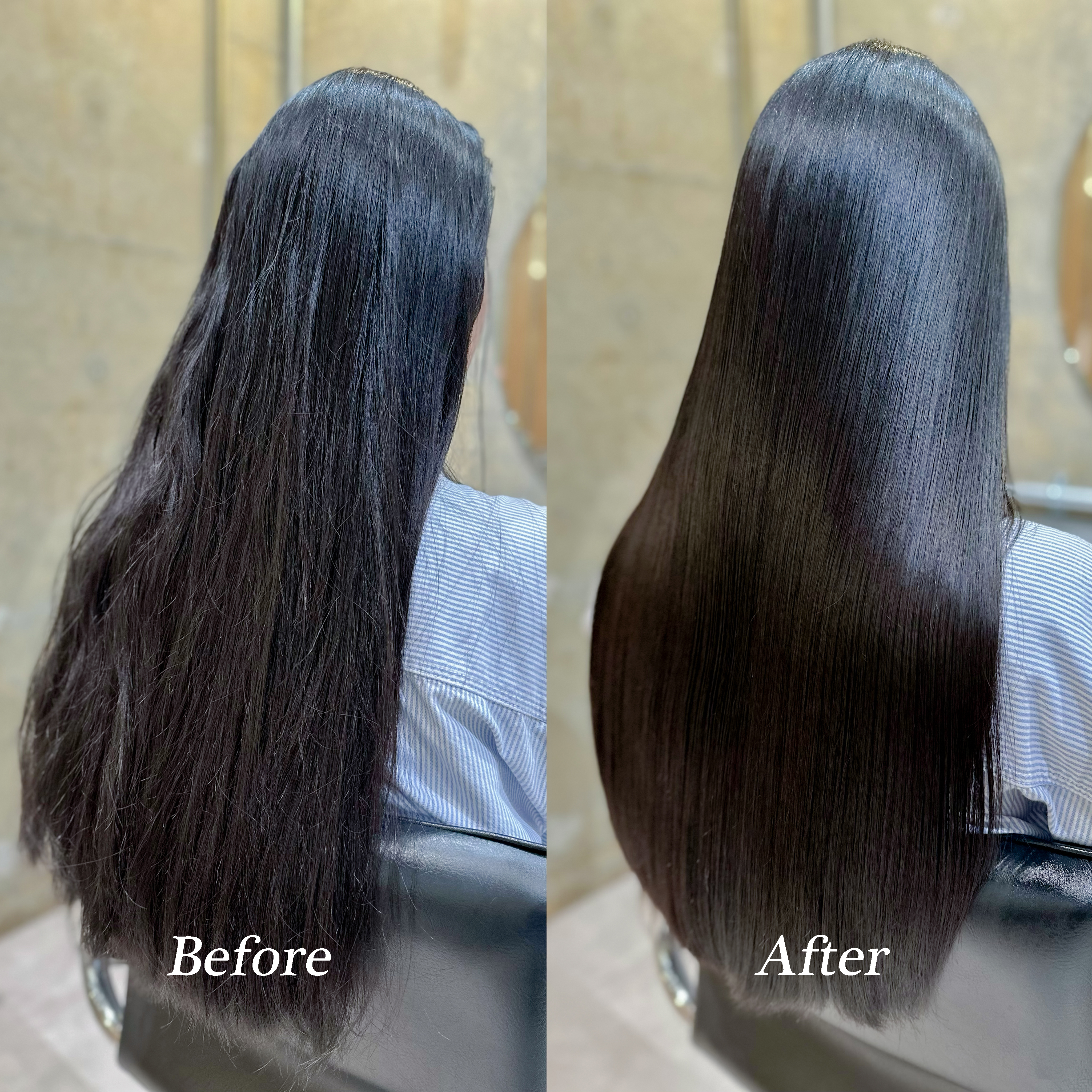 施術例6 - Before & After