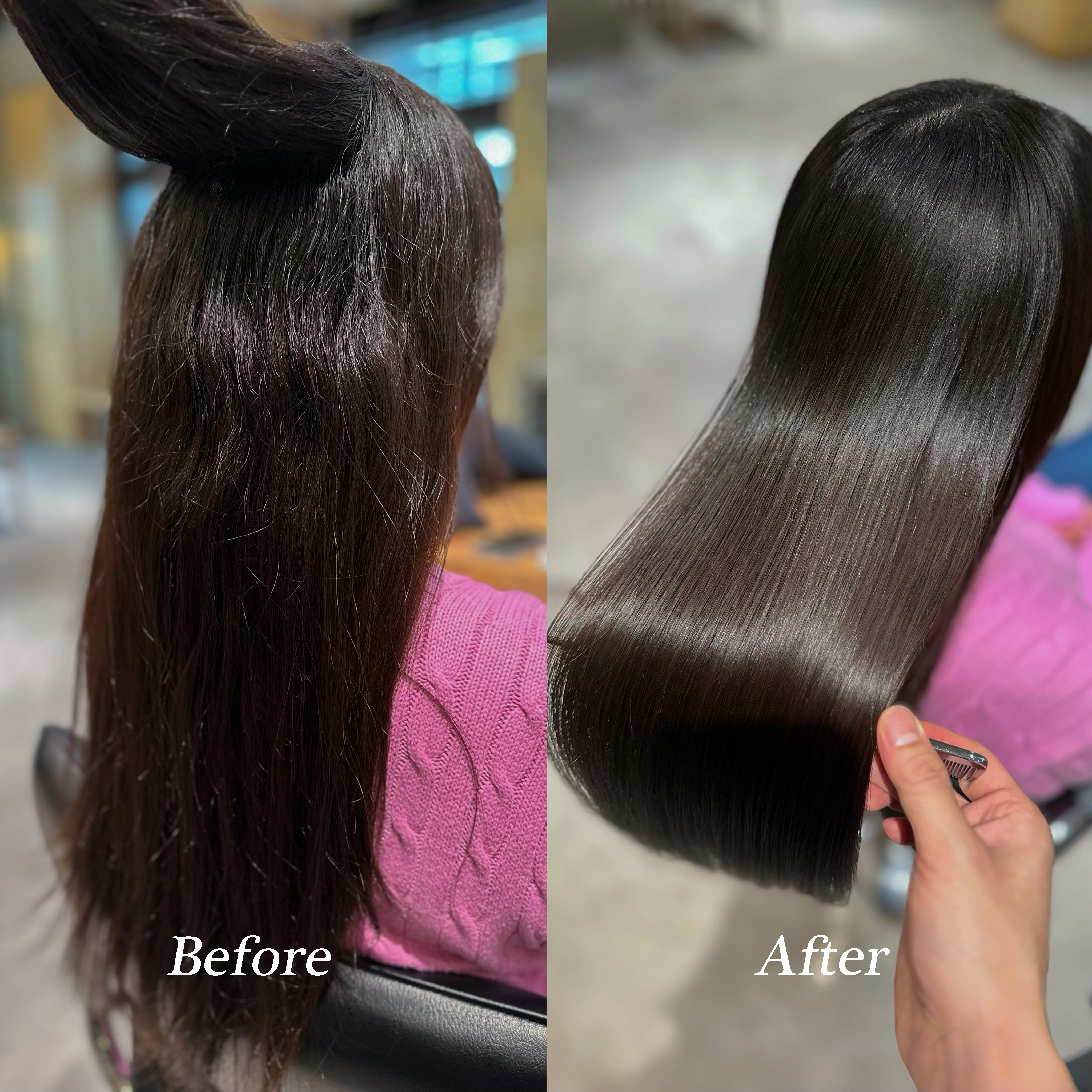 施術例7 - Before & After